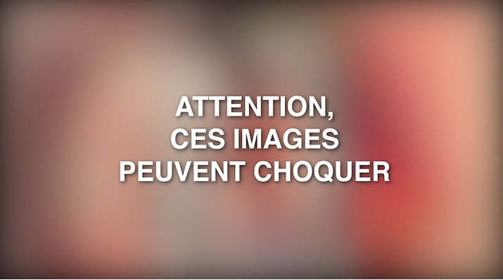 attention images choquer