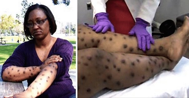 tondu pelouse corps ravagé