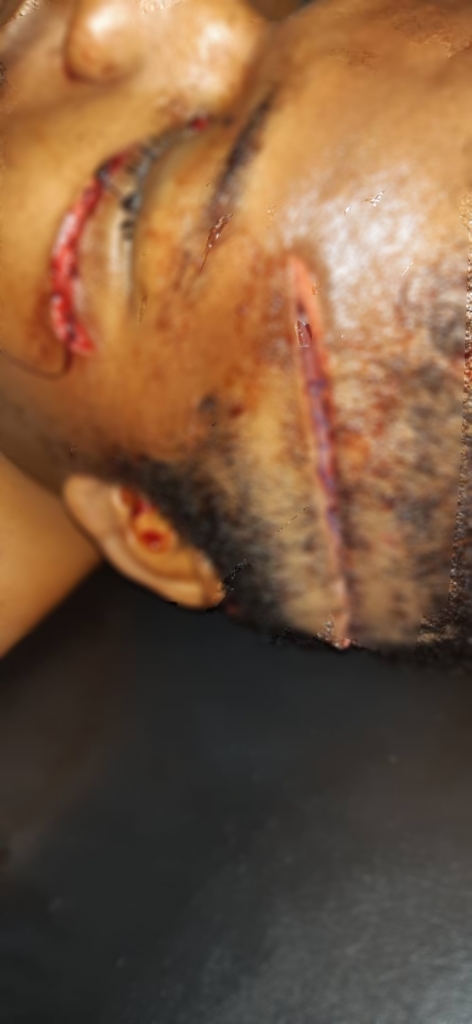 afterfocus 1579773750162