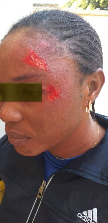 prof blessé blaise diagne